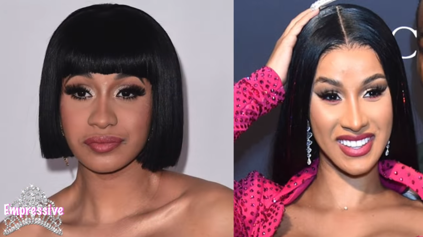 Did Cardi B Get Plastic Surgery? - Eelive